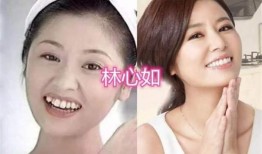 牙医爆料明星整牙视频,牙医亲述整牙全过程